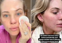 Toxic Truth skin disorders