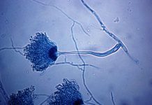 180 Species of Aspergillus Aspergillus