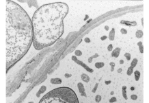 Background On Microbial Contamination In Water Damaged Buildings Microbial Contamination in Water Damaged Buildings