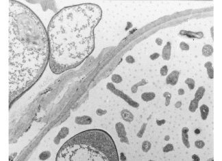 Background On Microbial Contamination In Water Damaged Buildings Microbial Contamination in Water Damaged Buildings