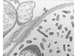Background On Microbial Contamination In Water Damaged Buildings Microbial Contamination in Water Damaged Buildings