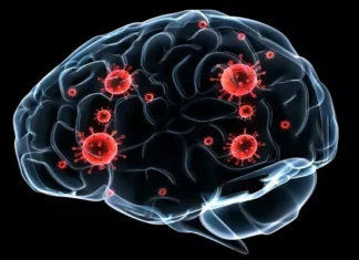 Mould, Bacteria And Dementia Link Mould and Dementia Link