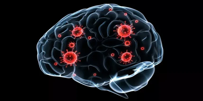 Mould, Bacteria And Dementia Link Mould, Bacteria And Dementia Link