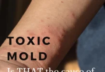 Mould, Bacteria And Skin Irritation Mould and Skin Irritation