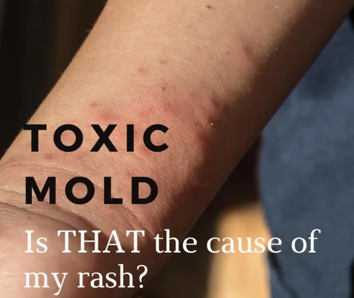 Mould and Skin Irritation