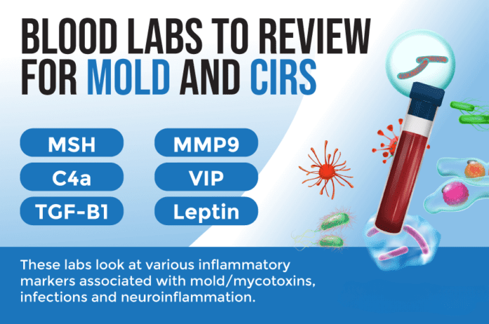 cirs blood test cirs blood test